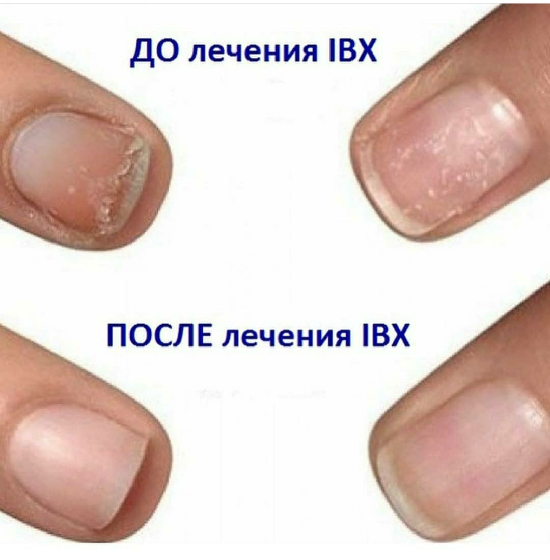 Ногти после аппаратного маникюра. Ногти после IBX. Пропилы на ногтях после аппаратного. Пропилы на ногтях после аппаратного маникюра.