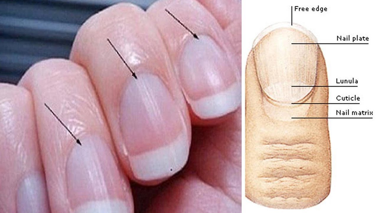 Полосы на ногтях что значит. Продольные борозды на ногтях. Продольные полоски на ногтевой пластине. Повреждение матрикса ногтя.