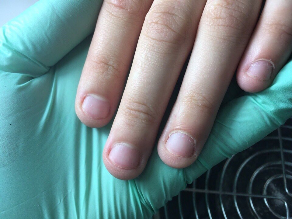 Почему ноготь маленький. Ногти короткие. Короткие ногти с маленькой ногтевой пластиной. Короткая ногтевая поасти. Короткие и широкие ногти на руках.